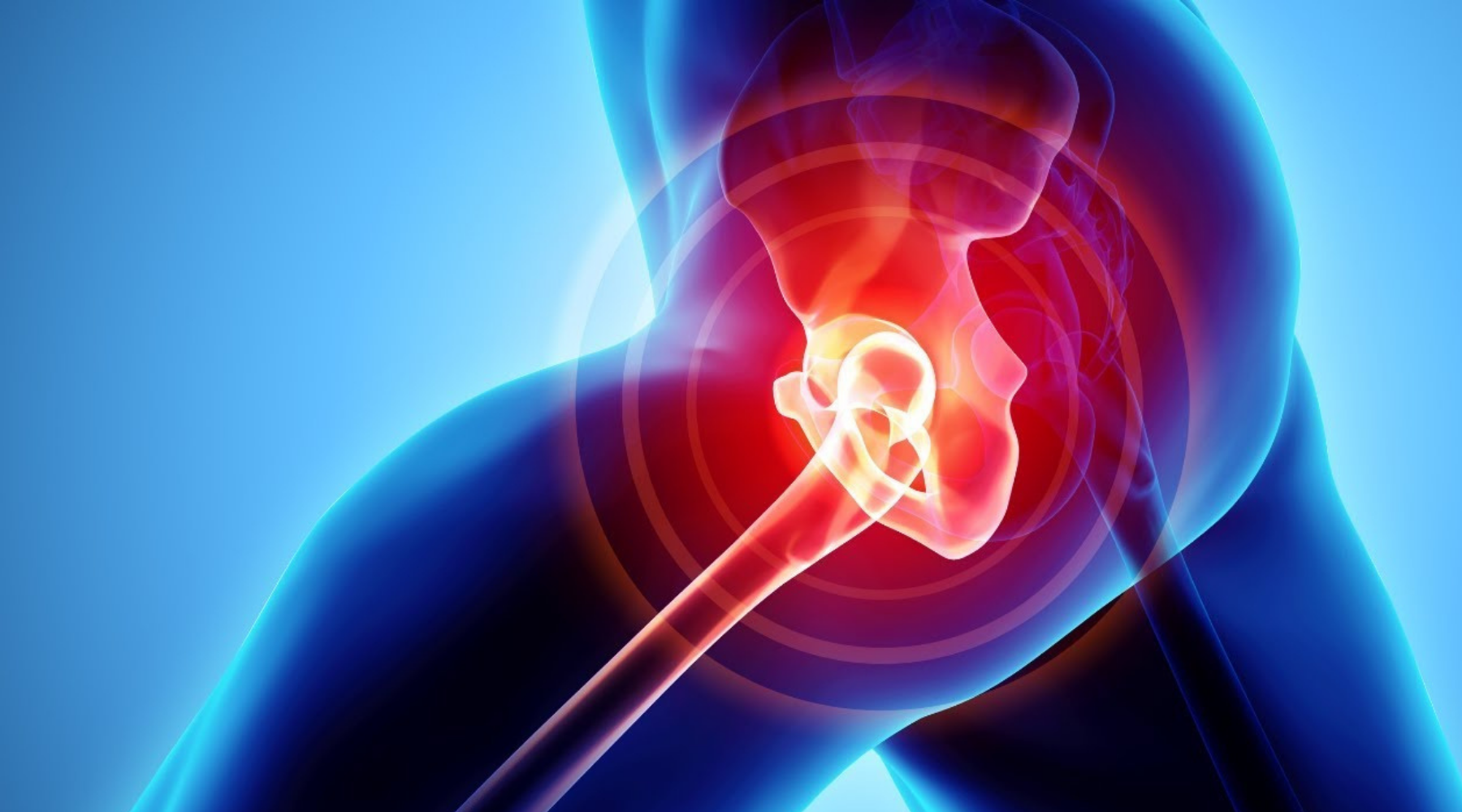 Benefits Of CBD For Hip Bursitis Hemp Life Mag