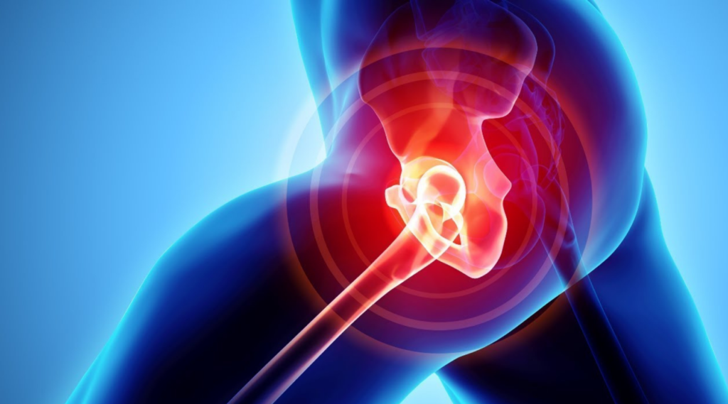 Benefits of CBD for Hip Bursitis wallpaper
