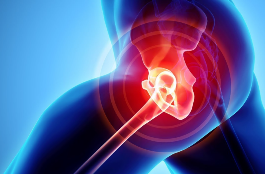 Benefits of CBD for Hip Bursitis wallpaper